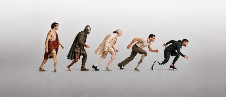 От палки с ослиным копытом до нейромышечных интерфейсов: 3000 лет эволюции протеза