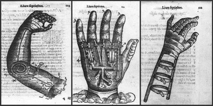 Ранние протезы руки с шарнирной механикой и фиксируемыми положениями пальцев
