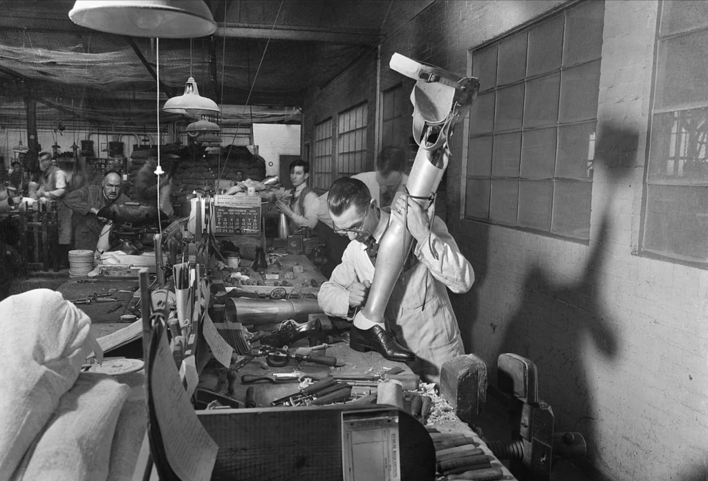 Фабрика по изготовлению искусственных конечностей в лондонской больнице