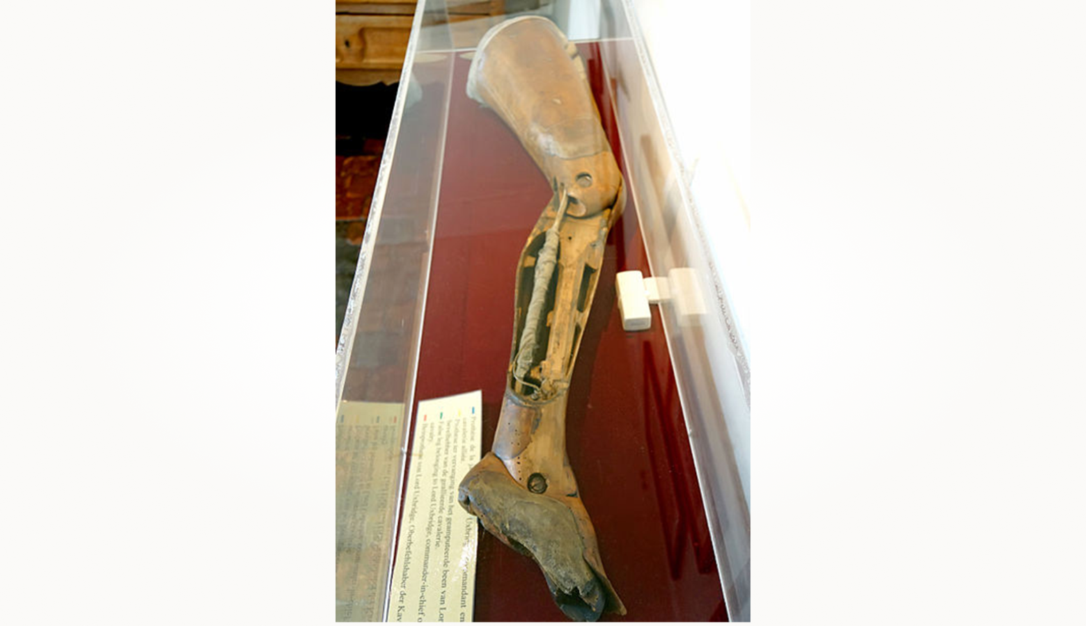 Протез шарнирной ноги. 